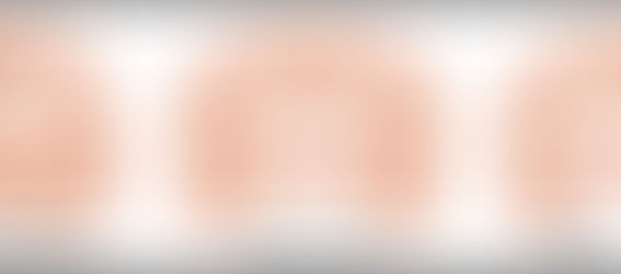 Etapas del Alzheimer