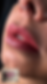 Velvet Lips direkt nach der Behandlung mit Vorher-Vergleich