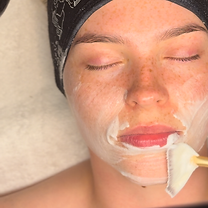 Chemical Peel Leeds