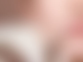 How Long Do Lip Fillers Last?
