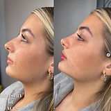 b12 injection leeds Vitamin B12 Injections | Leeds