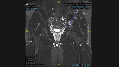 Complex Orthopedic Surgery: Collaboration and Technology at the Heart of the Procedure