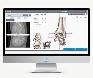 3D-Arthro Ankle: Simplifying the Management of Ankle Pathologies