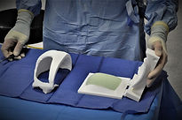3D-Skull Cranioplasty Patient Specif implant