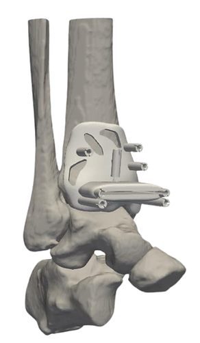 Copy of Arthro Knee.png