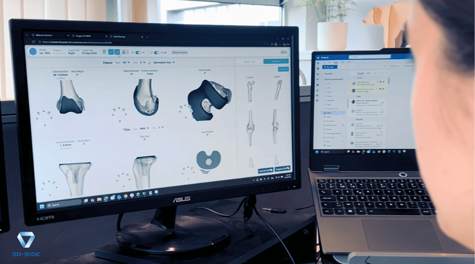 3D-Side planning software displaying personalized knee implant components on screen
