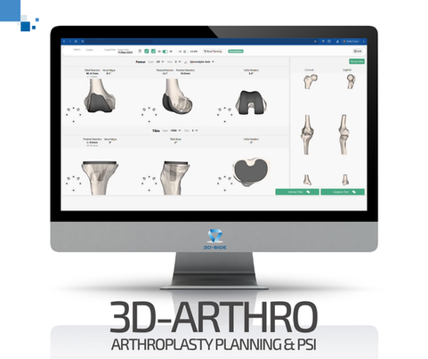 3D-Arthro Knee: focused on precision in knee arthroplasty!