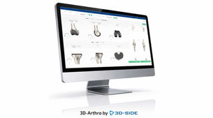 3D surgical planning software displaying knee anatomy and implants on a desktop screen for total knee arthroplasty preparation