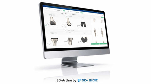 3D surgical planning software displaying knee anatomy and implants on a desktop screen for total knee arthroplasty preparation