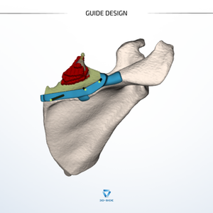 The validated guide design for Option 1