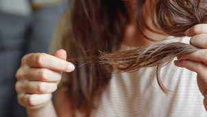 Hair Loss in Perimenopause: What’s Happening & What Helps