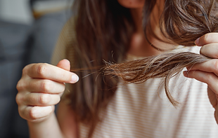 woman with hair loss