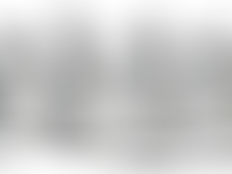 Discover the Robotic Knee Replacement Benefits: A New Era in Joint Care