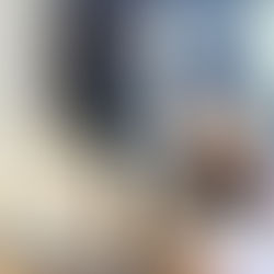 Do I Need Knee Surgery or Is There Another Option? Expert Advice From a Knee Pain Specialist in North Texas