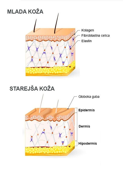Koza.jpg
