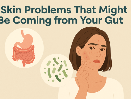 Why You Break Out After Antibiotics (And How to Fix It)