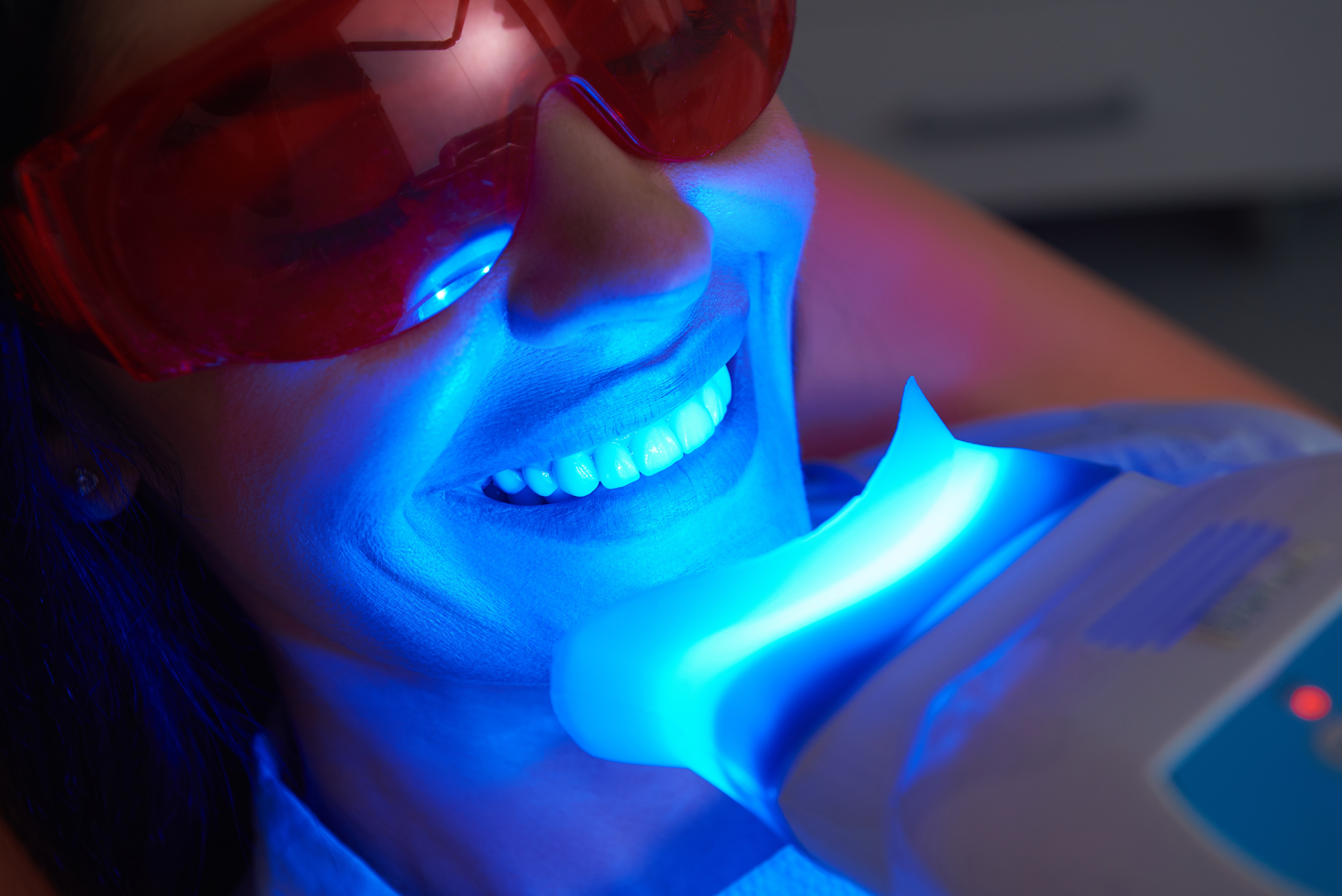 Bleaching Gutschein