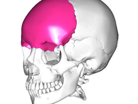 目の下の弛みと瞼のもたつきは、前頭骨の下垂が原因！？