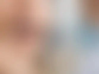 Oprava zlomeného zuba: čo robiť hneď