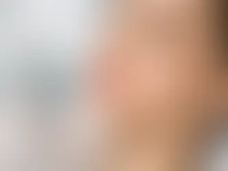 Kyselina hyalurónová pery Nitra: čo čakať
