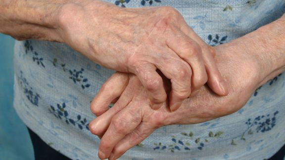 Hand osteoarthritis has its challenges, but there are several ways you can make some simple lifestyle adjustments to live more comfortably with this condition.