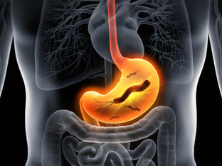 Cuidado con la Helicobacter Pylori