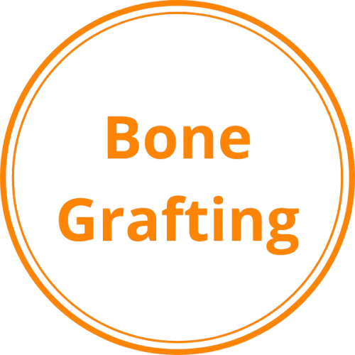 Bone Grafting Icon.png