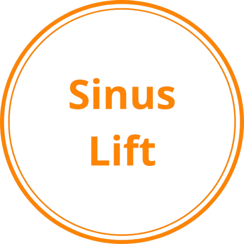 Sinus Lift Icon.png