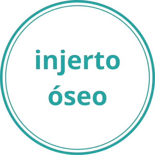 Injerto óseowebp.webp