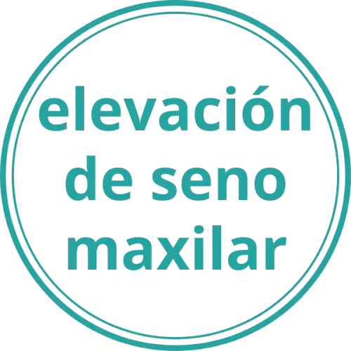 Elevación de seno maxilar.webp