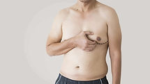 gynecomastia.jpg