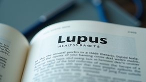 Understanding Key Facts About Lupus