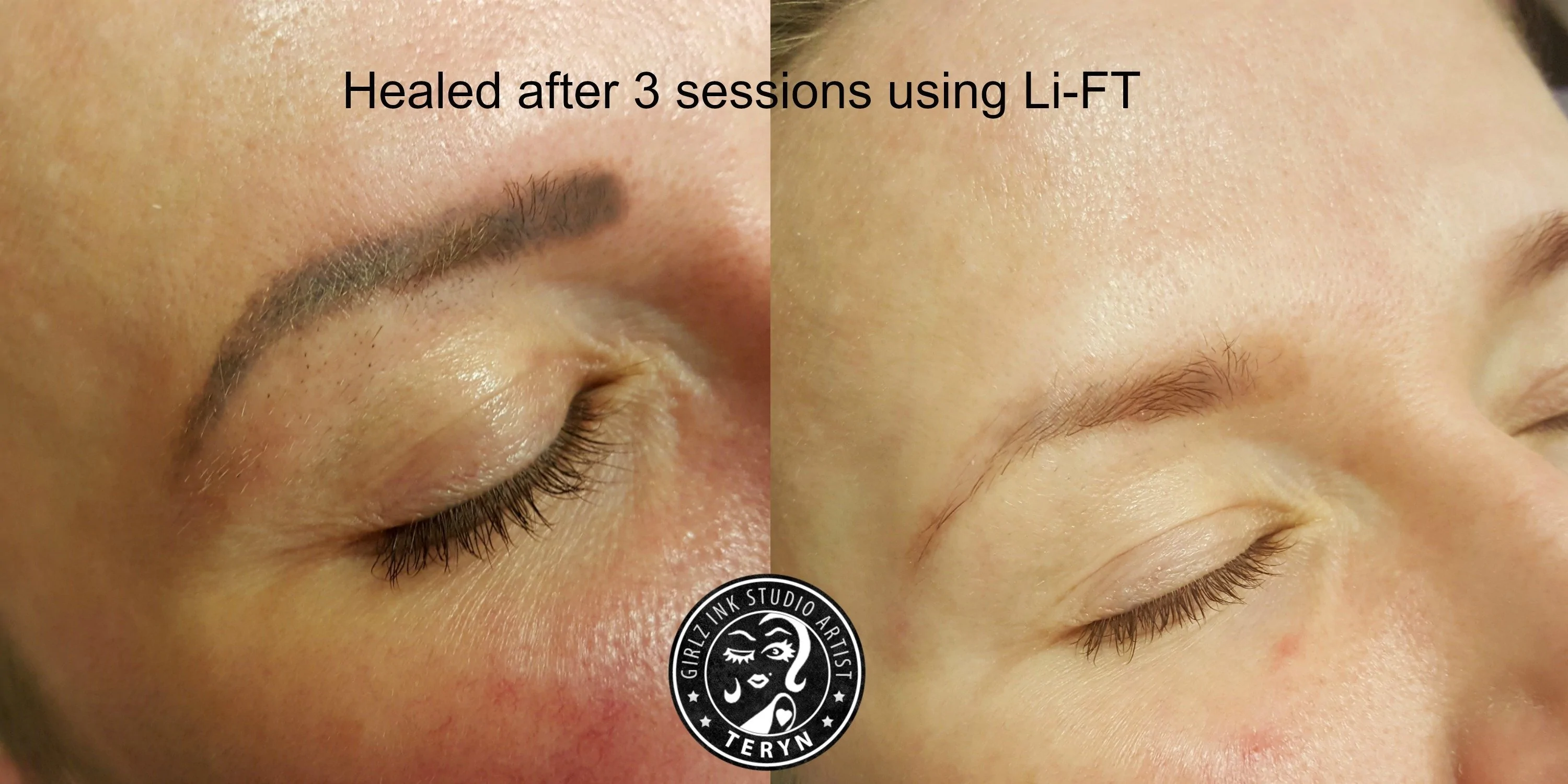 healed_3_sessions_5000x.webp