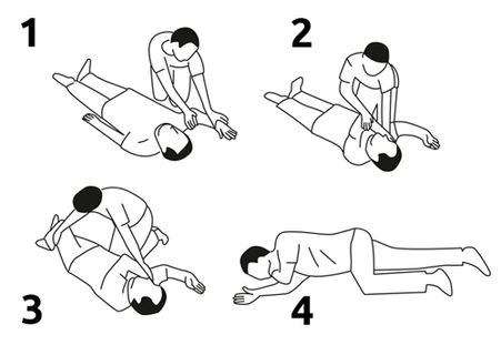 What is Naloxone?