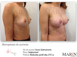 fotos web.044