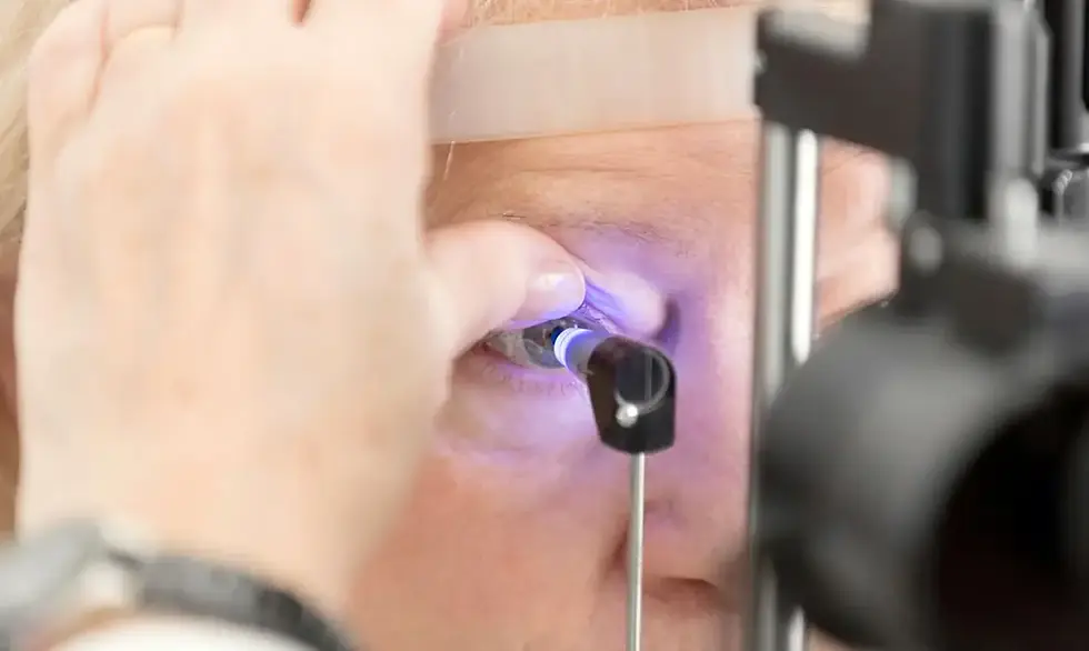 Glaucoma atinge 4% das pessoas acima de 40 anos