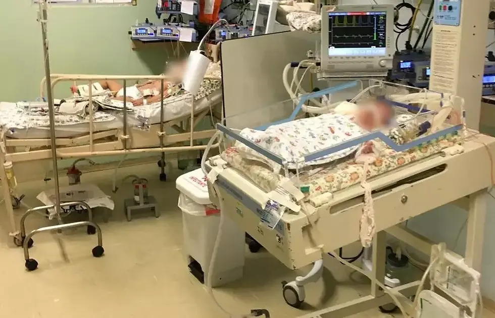 Crianças em UTI pediátrica no pós-operatório da Santa Casa. (Foto: Arquivo pessoal)
