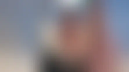 Mulher faz transplante inédito e recupera visão após 5 anos sem enxergar