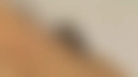 Apesar de morte e surto em Dourados, Campo Grande não tem casos de chikungunya em 2026