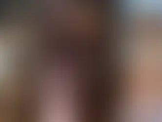 Obesidade é doença crônica e lipedema pode estar por trás de dores e inchaço nas pernas