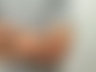 Secretaria de Saúde da Bahia nega casos de Mpox