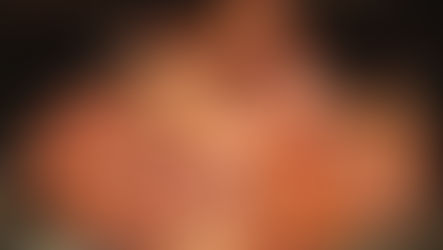 Bacon, salsicha e presunto entram em lista de alimentos cancerígenos da OMS