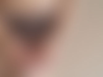 Condição pouco conhecida faz mulheres conviverem com dor íntima crônica
