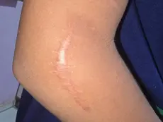 Mães relatam novos casos de negligência nas UPAs após morte de menino de 9 anos