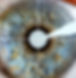 Auge Laserbehandlung