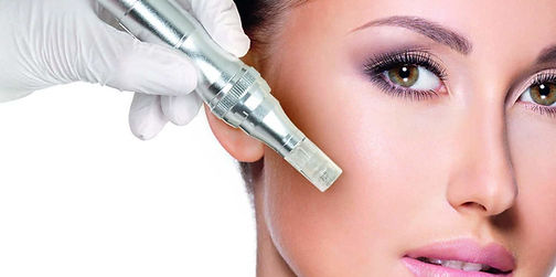 Microneedling non-surgical skin rejuvenation procedure in Sabetian Natural Appearance Clinic auckland