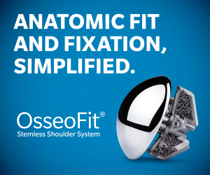 A0476-1-US-en OsseoFit Programmatic Adverts-AUG2025-300x250_1.gif