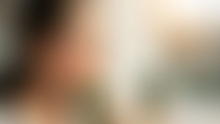 La verdad sobre el daño solar acumulativo y cómo protegerte.