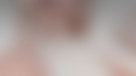성형 업종에서 고객 관리 마케팅이 더 효과있는 이유