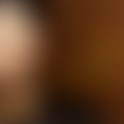 Beautiful skin and chocolate addiction